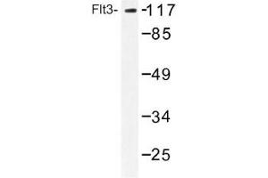 Image no. 1 for anti-Fms-Related tyrosine Kinase 3 (FLT3) antibody (ABIN317712) (FLT3 antibody)