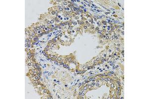 Immunohistochemistry of paraffin-embedded human prostate using GM13125 antibody. (Pramel15 antibody)