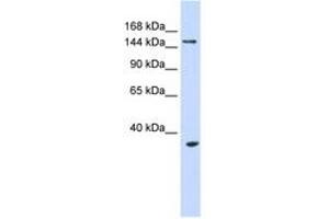 Image no. 1 for anti-Ubiquitin Protein Ligase E3B (UBE3B) (AA 720-769) antibody (ABIN6740821)