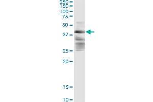 Immunoprecipitation of ZFYVE19 transfected lysate using anti-ZFYVE19 monoclonal antibody and Protein A Magnetic Bead , and immunoblotted with ZFYVE19 MaxPab rabbit polyclonal antibody. (ZFYVE19 antibody  (AA 1-396))