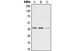 Western blot analysis of ZADH2 expression in Jurkat (A), Raw264. (ZADH2 antibody  (Center))