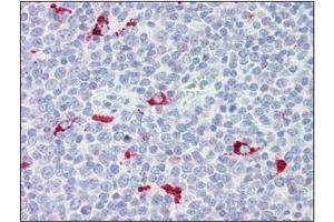 Immunohistochemistry (IHC) image for anti-Interferon Regulatory Factor 7 (IRF7) (AA 1-150), (N-Term) antibody (ABIN263914) (IRF7 antibody  (N-Term))
