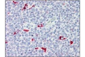 Immunohistochemistry (IHC) image for anti-Interferon Regulatory Factor 7 (IRF7) (AA 1-150), (N-Term) antibody (ABIN263915) (IRF7 antibody  (N-Term))