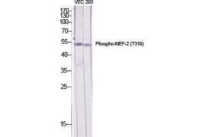 Western Blot (WB) analysis of specific cells using Phospho-MEF-2 (T319) Polyclonal Antibody. (MYEF2 antibody  (pThr319))
