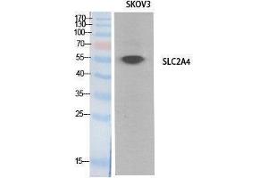 Western Blotting (WB) image for anti-Solute Carrier Family 2 (Facilitated Glucose Transporter), Member 4 (SLC2A4) (Internal Region) antibody (ABIN3178539) (GLUT4 antibody  (Internal Region))