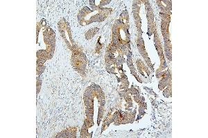 IHC analysis of BUB1B using anti-BUB1B antibody (ABIN7600962).