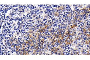 Detection of CD23 in Human Amygdalitis Tissue using Polyclonal Antibody to Cluster Of Differentiation 23 (CD23) (FCER2 antibody  (AA 151-321))