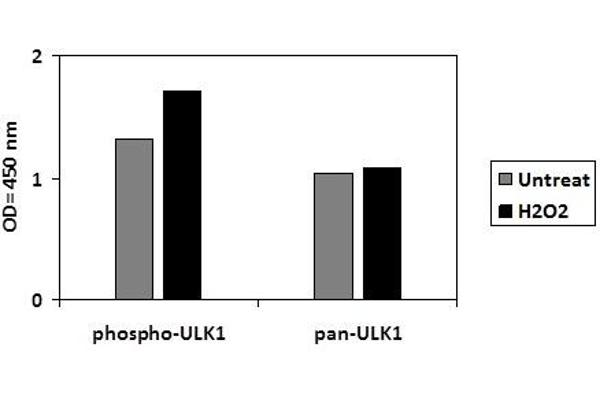 ULK1 ELISA Kit