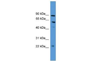 WB Suggested Anti-PDZK1 Antibody Titration:  0. (PDZK1 antibody  (N-Term))