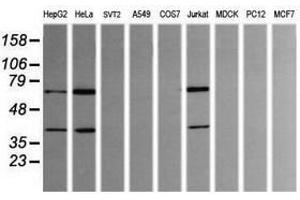 Image no. 1 for anti-tRNA Methyltransferase 2 Homolog A (TRMT2A) antibody (ABIN1501515) (TRMT2A antibody)