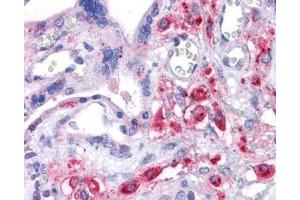 IHC testing of FFPE human placental tissue with XCT antibody at 3. (SLC7A11 antibody)