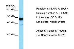 Western Blotting (WB) image for anti-NLR Family, Pyrin Domain Containing 3 (NLRP3) (N-Term) antibody (ABIN2789437) (NLRP3 antibody  (N-Term))