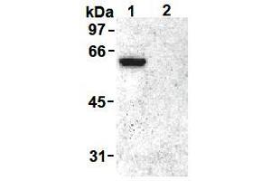 Western Blotting (WB) image for anti-Vimentin (VIM) (pSer55) antibody (ABIN1109485)