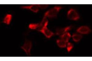 ABIN6274547 staining HeLa by IF/ICC. (JIP3 antibody  (Internal Region))