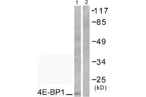 Western blot analysis of extracts from COS7 cells, treated with EGF (200ng/ml, 30mins), using 4E-BP1 (epitope around residue 69) antibody (ABIN5976164). (eIF4EBP1 antibody  (Thr70))