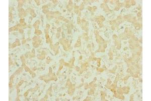 Immunohistochemistry of paraffin-embedded human liver tissue using ABIN7159686 at dilution of 1:100 (CHCHD3 antibody  (AA 1-227))