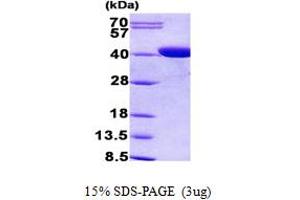 SDS-PAGE (SDS) image for Coproporphyrinogen Oxidase (CPOX) (AA 111-454) protein (His tag) (ABIN5852918) (CPOX Protein (AA 111-454) (His tag))