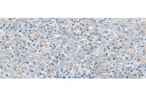 Immunohistochemistry of paraffin-embedded Human tonsil tissue using PYCR2 Polyclonal Antibody at dilution of 1:40(x200) (PYCR2 antibody)