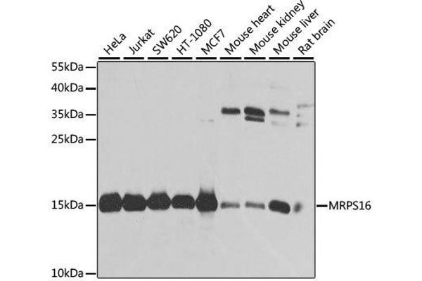 MRPS16 antibody  (AA 1-137)