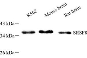 Western blot analysis of SRSF8 (ABIN7075558),at dilution of 1: 800 (SFRS2B antibody)