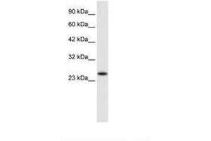 Image no. 1 for anti-Charged Multivesicular Body Protein 3 (CHMP3) (AA 28-77) antibody (ABIN6735908) (CHMP3 antibody  (AA 28-77))