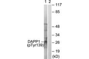 Western blot analysis of extracts from 293 cells treated with Insulin 0. (DAPP1 antibody  (pTyr139))