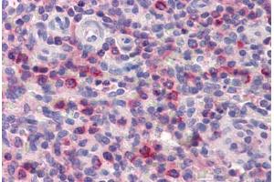 Human Spleen (formalin-fixed, paraffin-embedded) stained with ONECUT1 antibody ABIN462211 followed by biotinylated goat anti-rabbit IgG secondary antibody ABIN481713, alkaline phosphatase-streptavidin and chromogen. (ONECUT1 antibody  (C-Term))