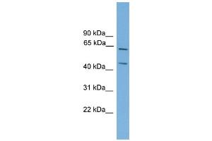 WB Suggested Anti-Rel Antibody Titration: 0. (c-Rel antibody  (Middle Region))