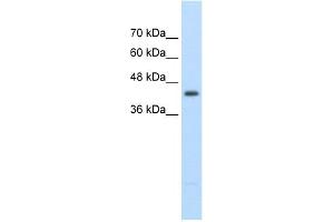 WB Suggested Anti-UPB1 Antibody Titration:  2. (UPB1 antibody  (Middle Region))