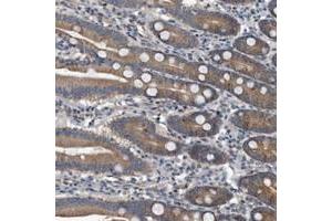 Immunohistochemical staining of human duodenum with FAM136A polyclonal antibody  shows moderate cytoplasmic positivity in glandular cells at 1:200-1:500 dilution.