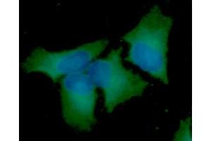 ICC/IF analysis of BECN1 in HeLa cells line, stained with DAPI (Blue) for nucleus staining and monoclonal anti-human BECN1 antibody (1:100) with goat anti-mouse IgG-Alexa fluor 488 conjugate (Green). (Beclin 1 antibody  (AA 1-450))