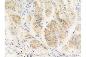 ABIN6256675 and ABIN6267240 at 1/100 staining human normal gastric tissue by IHC-P.