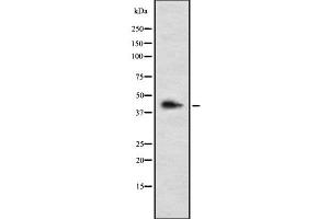 Western blot analysis of LHX3 using HepG2 whole cell lysates (LHX3 antibody  (C-Term))