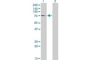 Western Blot analysis of EIF4G1 expression in transfected 293T cell line by EIF4G1 monoclonal antibody (M10), clone 2A9. (EIF4G1 antibody  (AA 1500-1599))