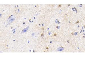 Detection of S100 in Bovine Cerebellum Tissue using Polyclonal Antibody to S100 Calcium Binding Protein (S100) (S100 Protein (S100) (AA 1-94) antibody)