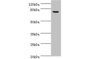 Western blot All lanes: ATRIP antibody at 8 μg/mL + PC-3 whole cell lysate Secondary Goat polyclonal to rabbit IgG at 1/10000 dilution Predicted band size: 86, 84, 77, 73 kDa Observed band size: 86 kDa (ATRIP antibody  (AA 1-260))