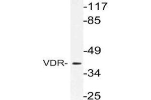 Western blot (WB) analysis of VDR antibody in extracts from Jurkat cells. (Vitamin D Receptor antibody)