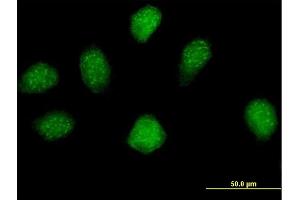 Immunofluorescence of purified MaxPab antibody to MGC16943 on HeLa cell. (ERI2 antibody  (AA 1-328))