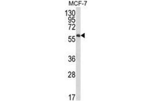 Western blot analysis of IL10RA Antibody (Center) in MCF-7 cell line lysates (35ug/lane).
