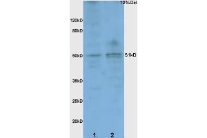 L1 rat brain lysates probed with Anti BACE1/ASP2 Polyclonal Antibody, Unconjugated (ABIN725705) at 1:200 overnight at 4 °C. (BACE1 antibody  (AA 401-501))