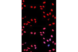 Immunofluorescence (IF) image for anti-Cyclin E1 (CCNE1) (pThr395) antibody (ABIN1870037) (Cyclin E1 antibody  (pThr395))
