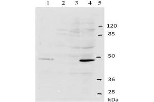 Western-Blot analysis of HPV-11 E2 protein. (Human Papilloma Virus 11 E2 (HPV-11 E2) (AA 202-284) antibody)