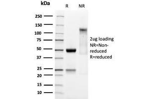SDS-PAGE Analysis Purified SOX9 Recombinant Rabbit Monoclonal Antibody (SOX9/3141R). (Recombinant SOX9 antibody  (AA 393-508))