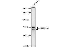 Western blot analysis of extracts of Rat brain, using HNRNPM antibody (ABIN7267635) at 1:1000 dilution. (HNRNPM antibody)