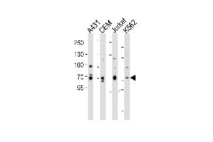 Western blot analysis of lysates from A431, CEM, Jurkat, K562 cell line (from left to right), using ITK Antibody (Center) (ABIN6243870 and ABIN6577737). (ITK antibody  (AA 228-262))