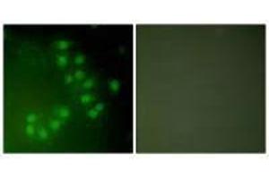 Immunofluorescence analysis of A549 cells, using p63 antibody. (p63 antibody)