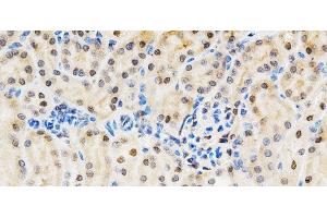 Immunohistochemistry of paraffin-embedded Mouse kidney using LGALS3 Polyclonal Antibody at dilution of 1:200 (40x lens). (Galectin 3 antibody)