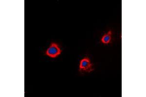 Immunofluorescent analysis of PTTG1IP staining in A549 cells. (PTTG1IP antibody  (Center))