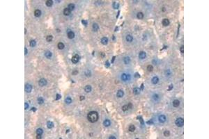 Figure. (TAF13 antibody  (AA 1-124))