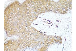 Immunohistochemistry of paraffin-embedded human skin using PDCD1 antibody (ABIN6290170) at dilution of 1:100 (40x lens). (PD-1 antibody)